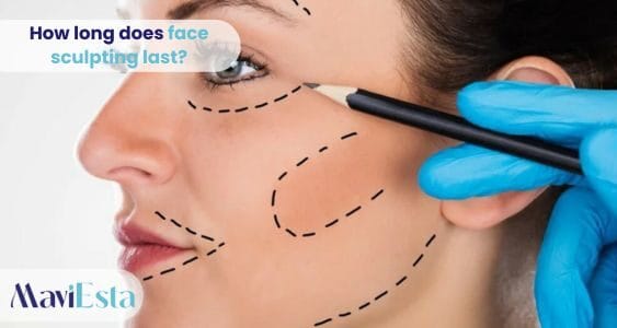 How long does face sculpting last