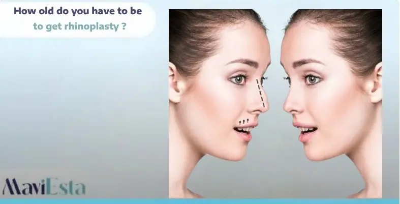 how old do you have to be to get rhinoplasty
