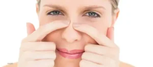 lump on nose after rhinoplasty