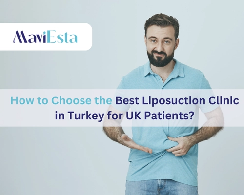How Much Does Liposuction Cost