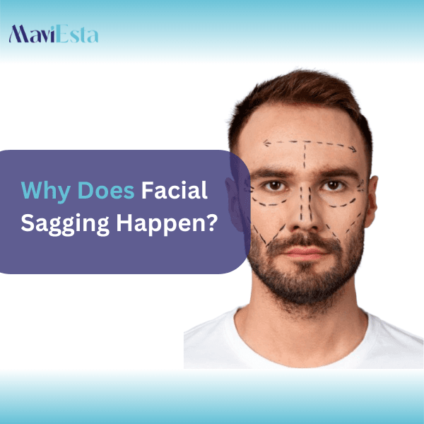 how to have a lifted face