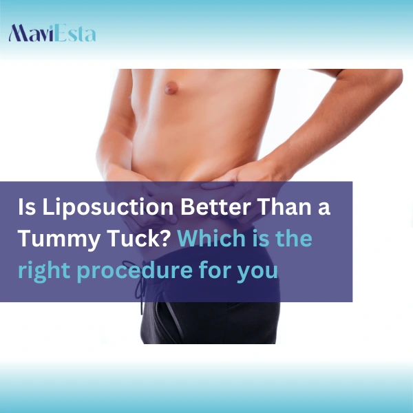 Is Liposuction Better Than a Tummy Tuck? Which is the right  procedure for you