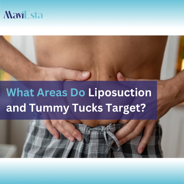 What Areas Do Liposuction and Tummy Tucks Target