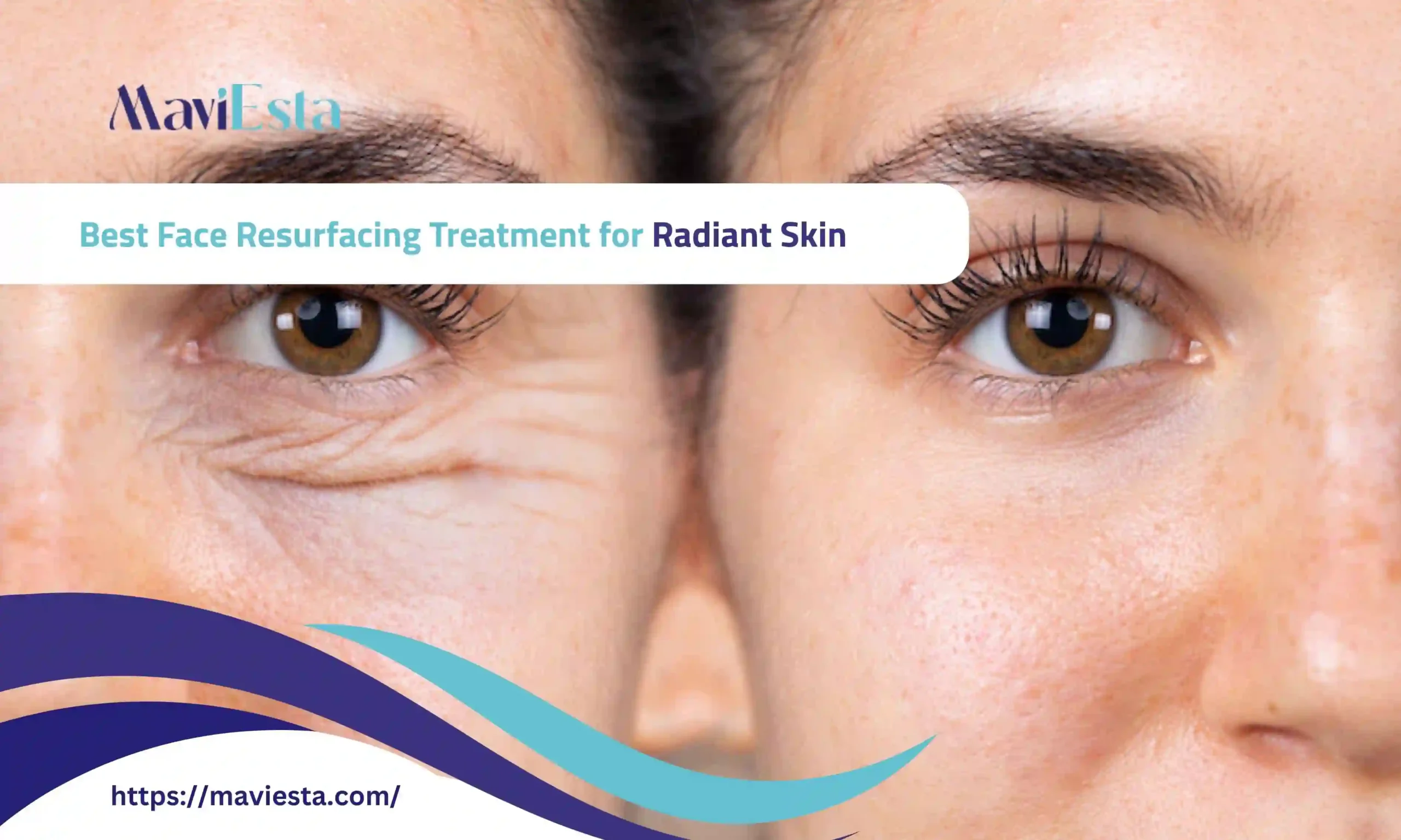 best face resurfacing treatment