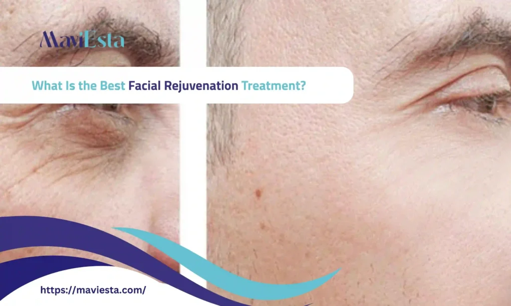 what is the best facial rejuvenation treatment