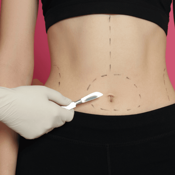 Liposuction 