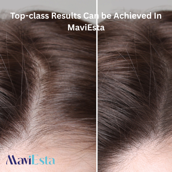 Top-class Results Can be Achieved In MaviEsta