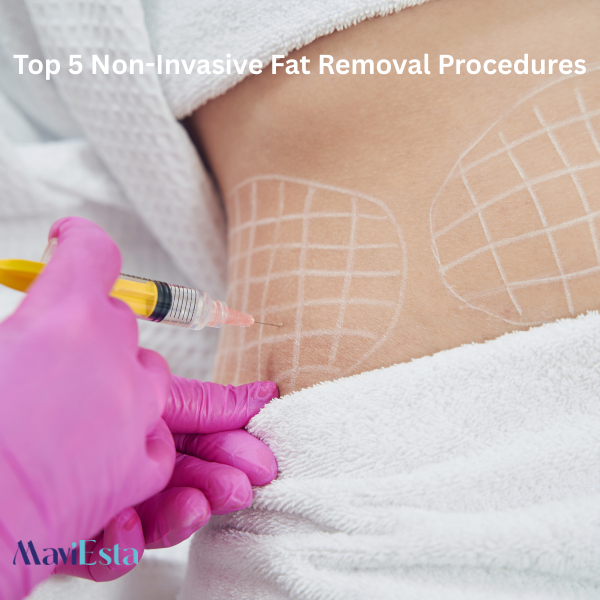 What Is the Best Fat Reduction Procedure