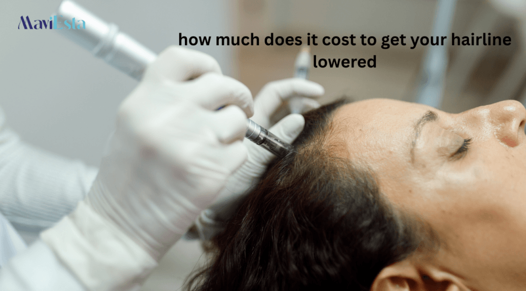 how much does it cost to get your hairline lowered