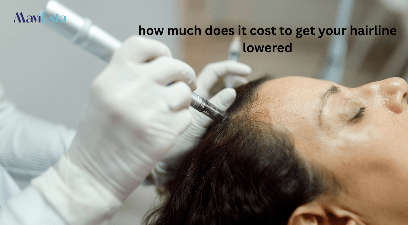 how much does it cost to get your hairline lowered