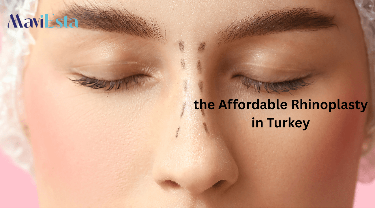 the Affordable Rhinoplasty in Turkey