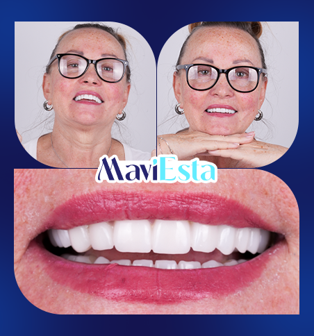 Dentistry In Turkey