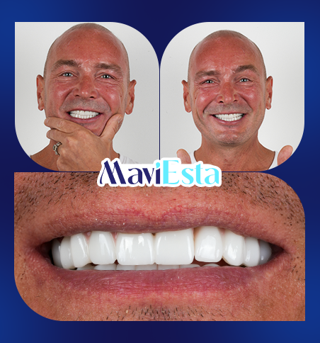 Dentistry In Turkey