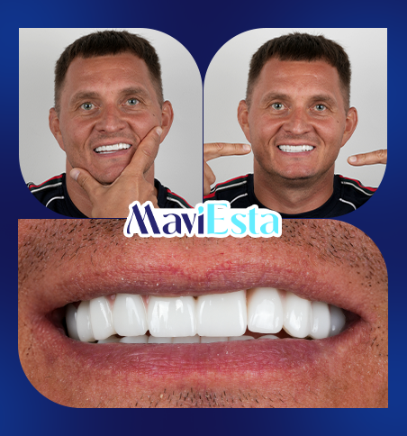Dentistry In Turkey