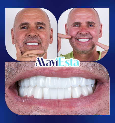 Dentistry In Turkey