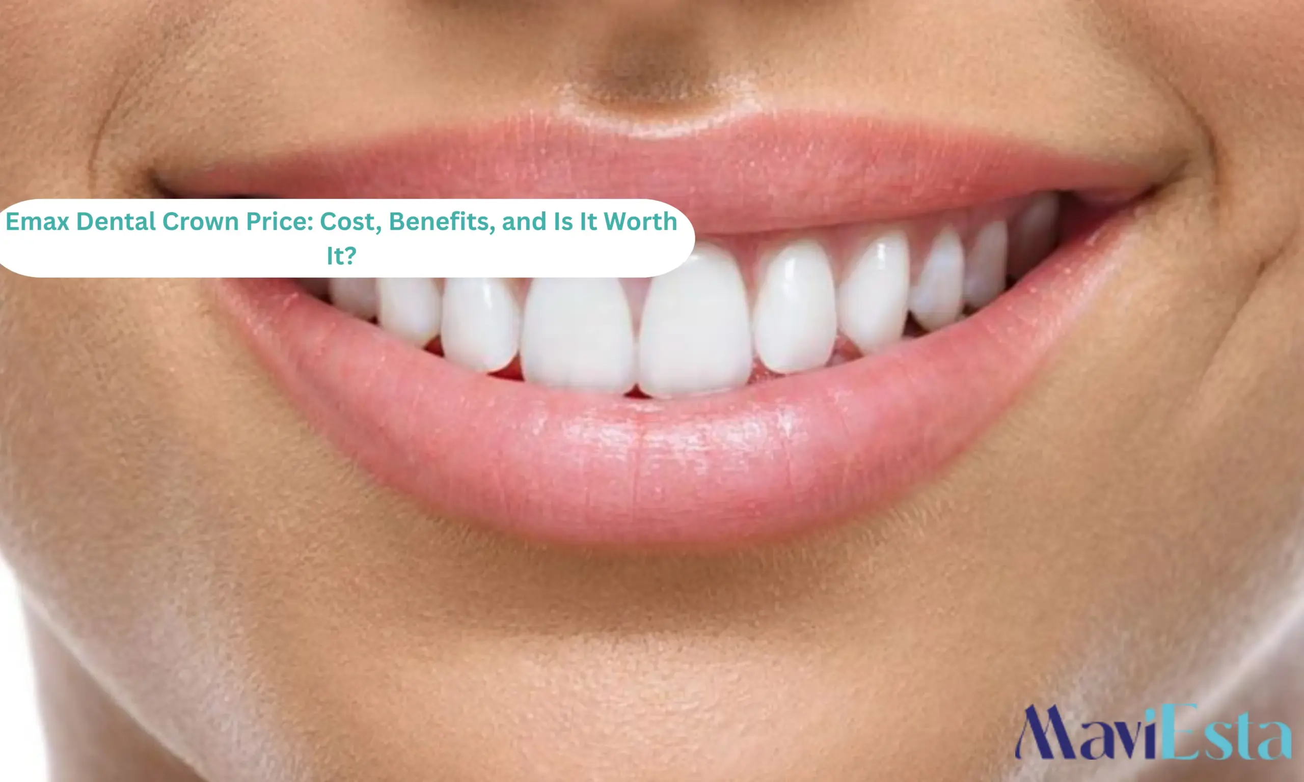 Emax Dental Crown Price