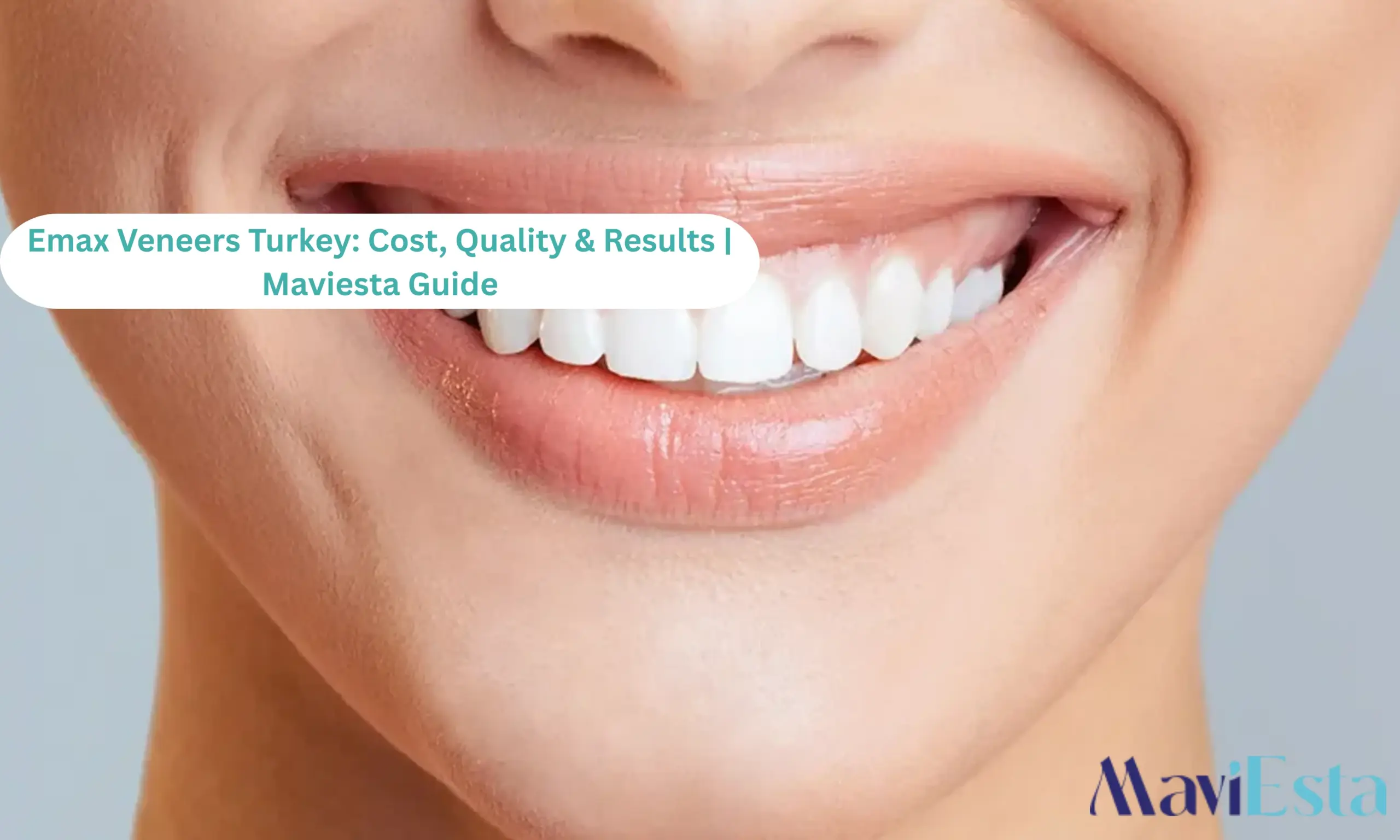 Emax Veneers Turkey