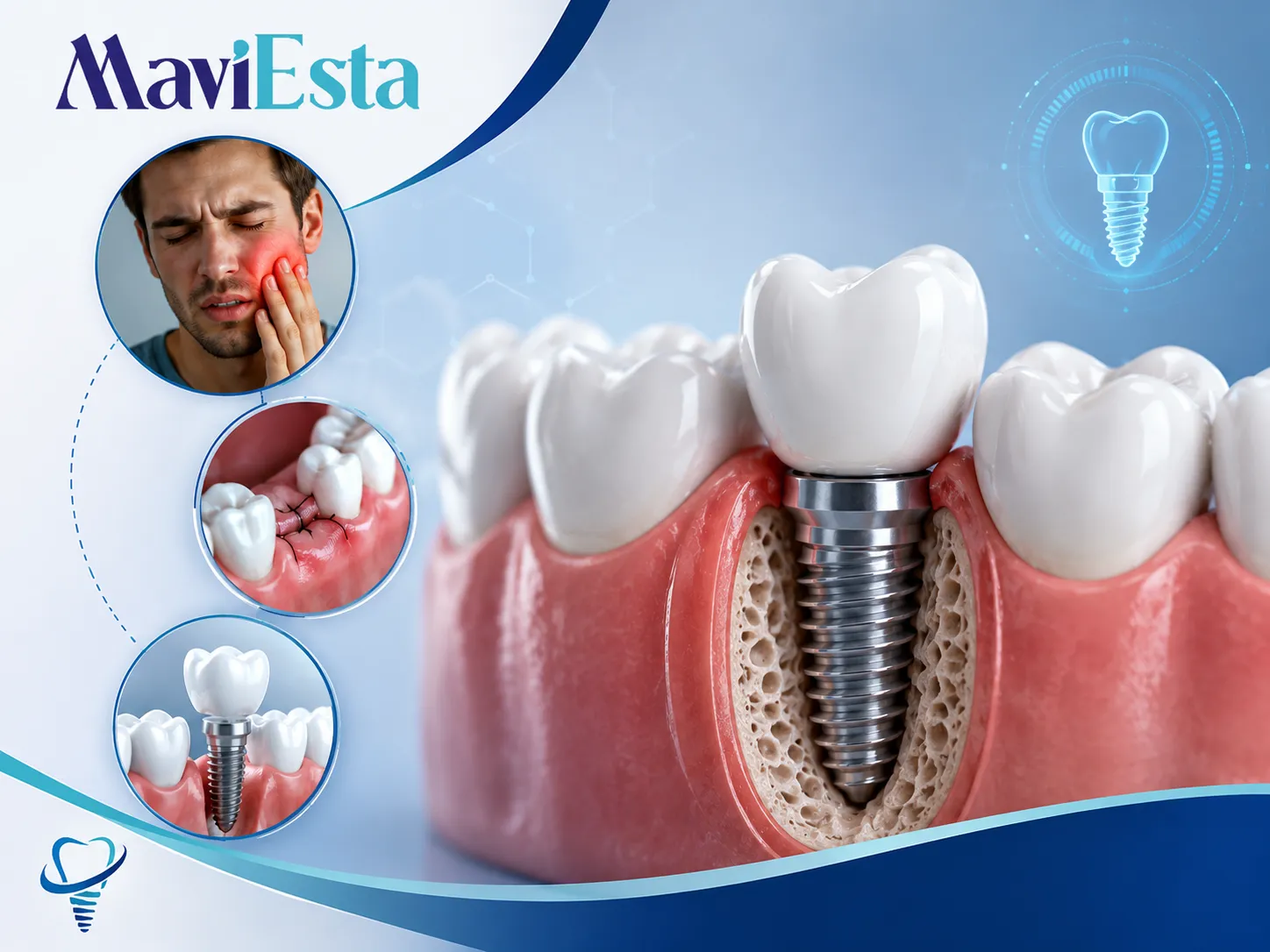 Throbbing Pain After Dental Implant Crown